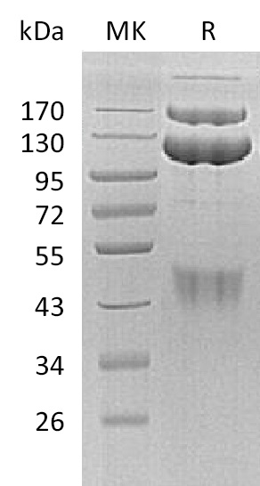 Human HGF R +SDS-PAGE-2.jpg